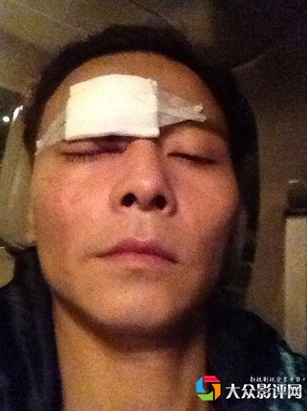 明星网红受伤事件,网络热议背后的人身安全警钟