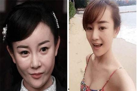 整容失败明星网红